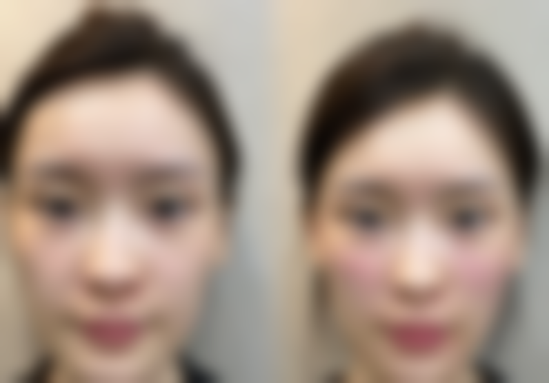 六、桂林诺澜登整形美容诊所怎么预约：