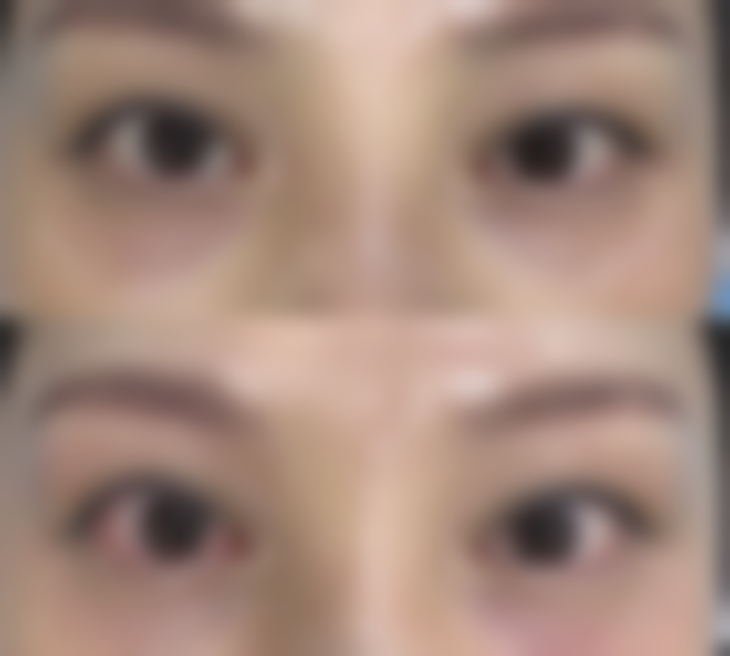 六、西安吉丽朵整形医院怎么预约：