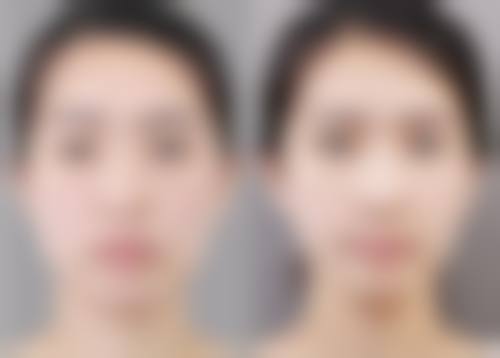 八、北京慈康医院整形科真实的顾客评价如下: