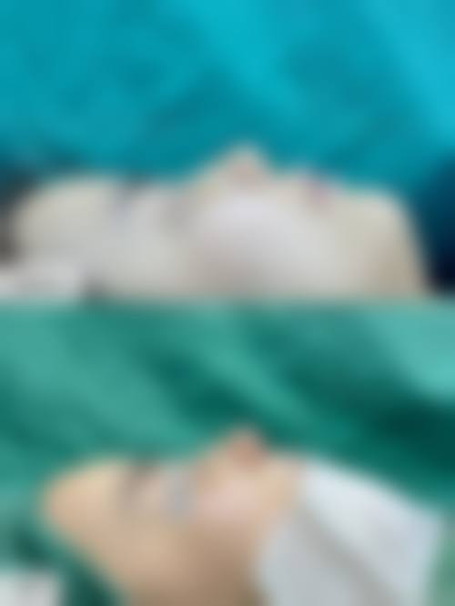 五、兰州中泰激光整形美容中 心实例