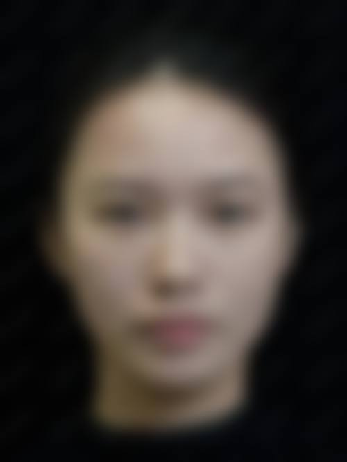 八、韩国在敦整形医院真实的顾客评价如下：