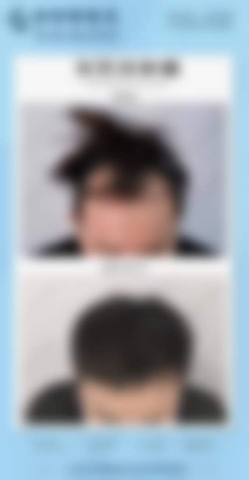 二、杭州德臻植发医院(杭州分院)正规吗?来看看医院资质: