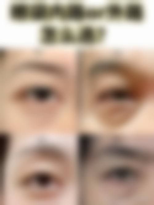 五、苏州帕丽斯整形医院怎么预约: