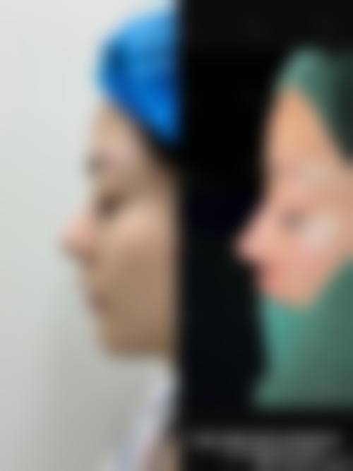 七、苏州帕丽斯整形医院真实的顾客评价如下: