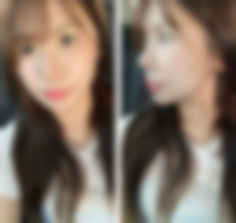 六、苏州帕丽斯整形医院价格表:(仅供参考)