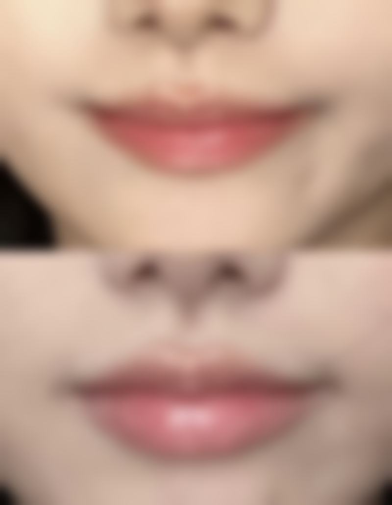 生姜助力去眼袋之改善眼周浮肿的奥秘