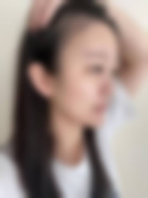 五、湖北宜昌雅现医疗美容门诊怎么预约：