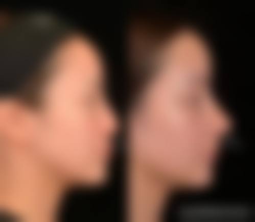 六、商城一美医疗美容诊所怎么预约：