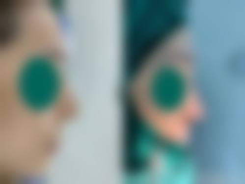 六、沈阳斯美诺医疗美容诊所怎么预约：