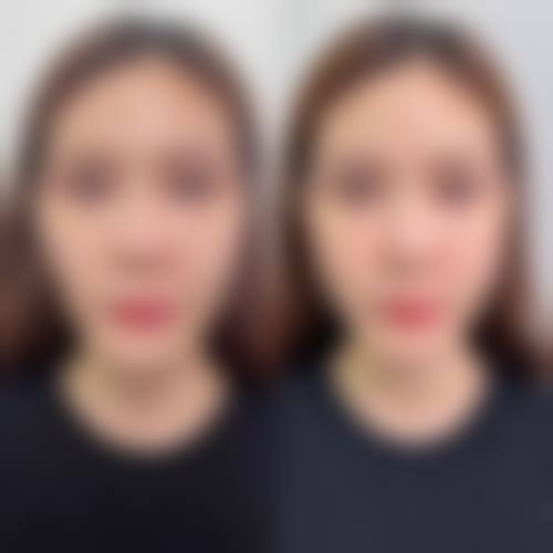 六、韩国首尔丽丝塔整形外科怎么预约：