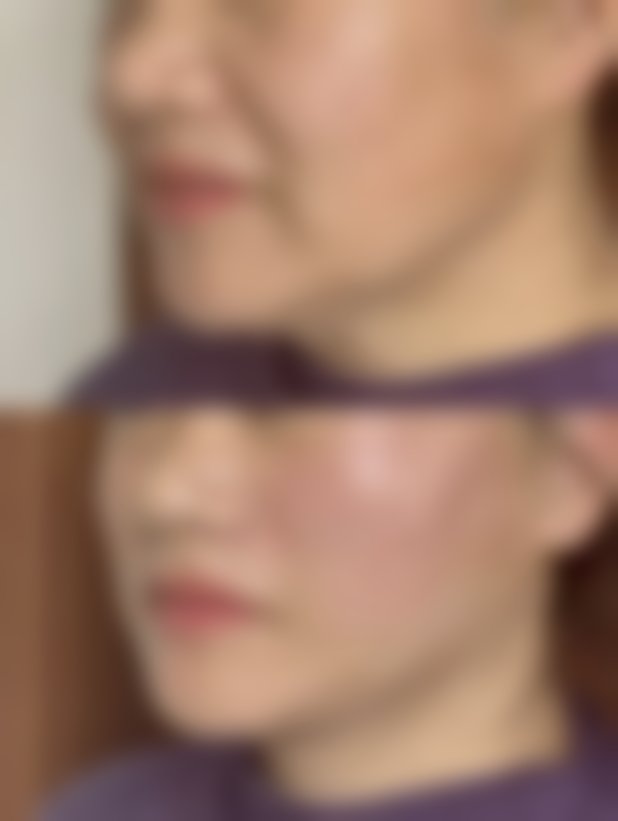 火眼金睛！从外观、手感、活动度多方面辨别隆胸与真胸的实用秘籍 