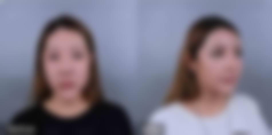 陈志俊医生在哪家医院怎么预约？