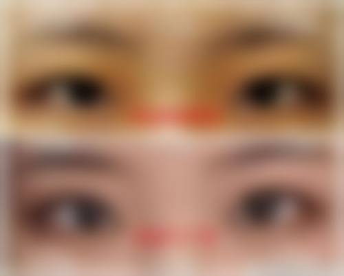 七、佛山顺德艺美整形医疗医院真实的顾客评价如下：