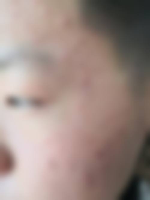 孔令达医生在哪家医院怎么预约？