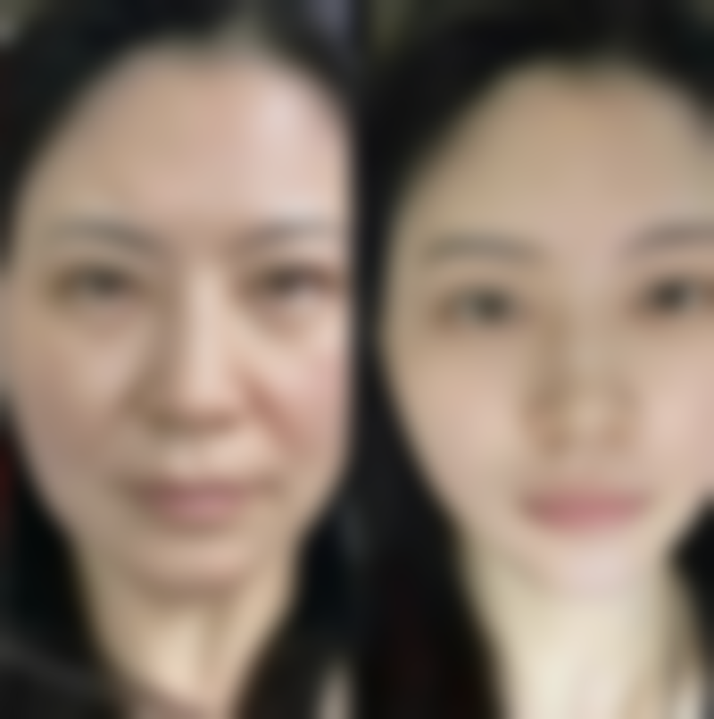 夏天到底能不能做双眼皮？代谢快、恢复时间足，做好护理轻松拥有迷人双眼 