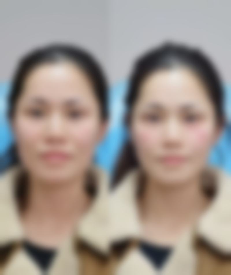 五、惠州伊丽莎白中韩整形美容中 心实例