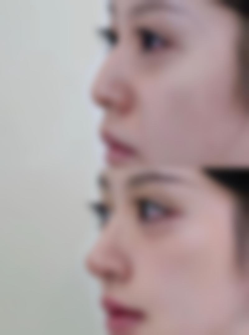 毛波医生在哪家医院怎么预约？