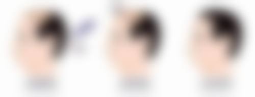 揭秘！成龙割双眼皮之地的服务特色秘诀