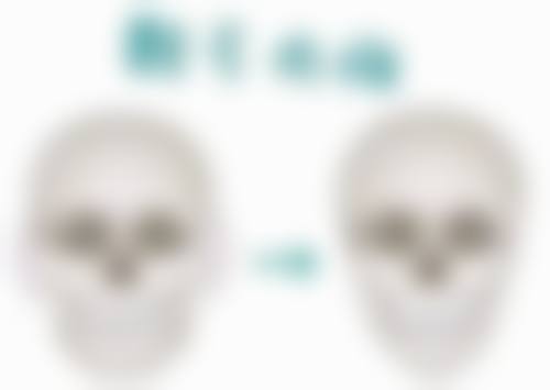 打瘦脸针后脸部僵硬别担心！了解修复周期和注意事项