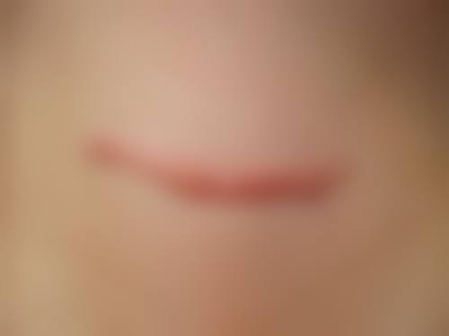 二、厦门174医院烧伤整形科正规吗？来看看医院资质：