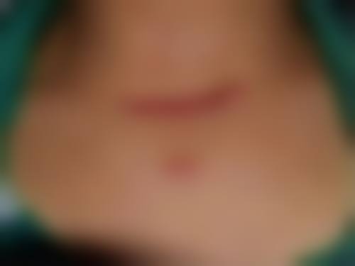 五、厦门广肤皮肤专科实例