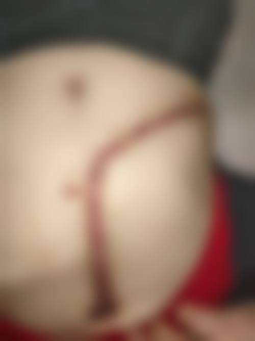 六、厦门广肤皮肤专科怎么预约：