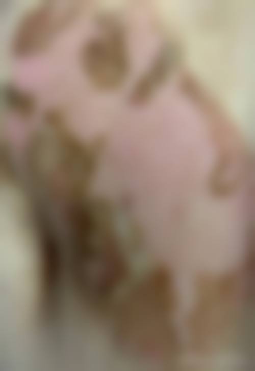 五、厦门174医院烧伤整形科怎么预约：