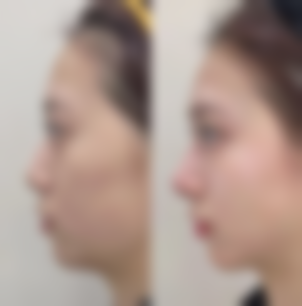 八、南充医美尔医疗美容整形门诊部真实的顾客评价如下：