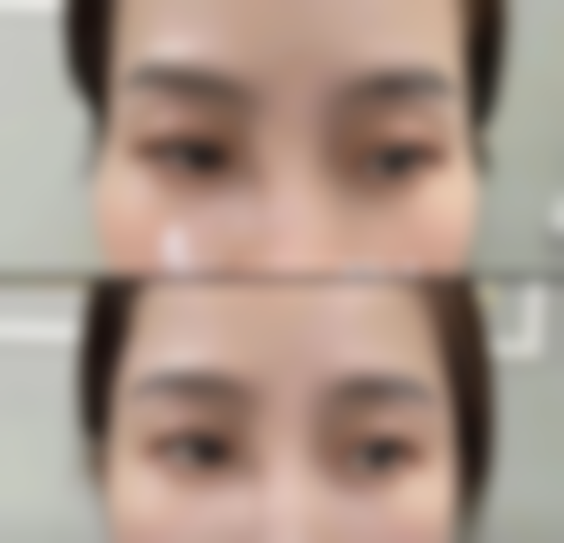 八、日本CharisClinic美容整形医院真实的顾客评价如下：