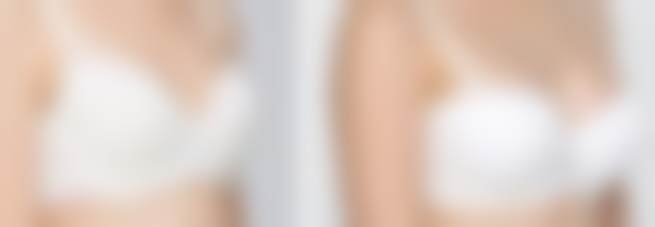 余恩艳医生怎么样可靠吗？