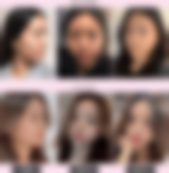 李允焕医生怎么样可靠吗？