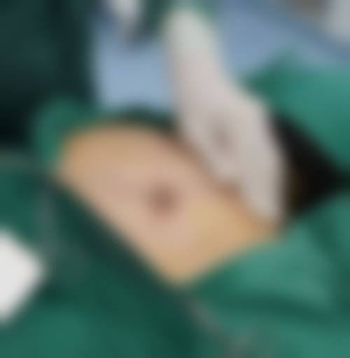 六、金华连天美整形美容医院怎么预约：