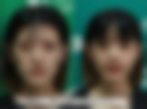 十几年烫伤疤痕修复：非手术治疗方法多