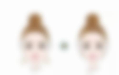 埋线双眼皮窄了如何调宽？多种方案精准修复，还你自然灵动大眼