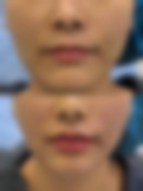 七、长春王巍医疗美容诊所真实的顾客评价如下：