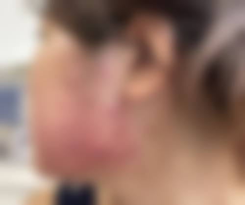 张娟华医生怎么样可靠吗？