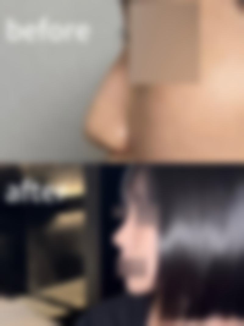 八、青岛朝晖整形医院真实的顾客评价如下：