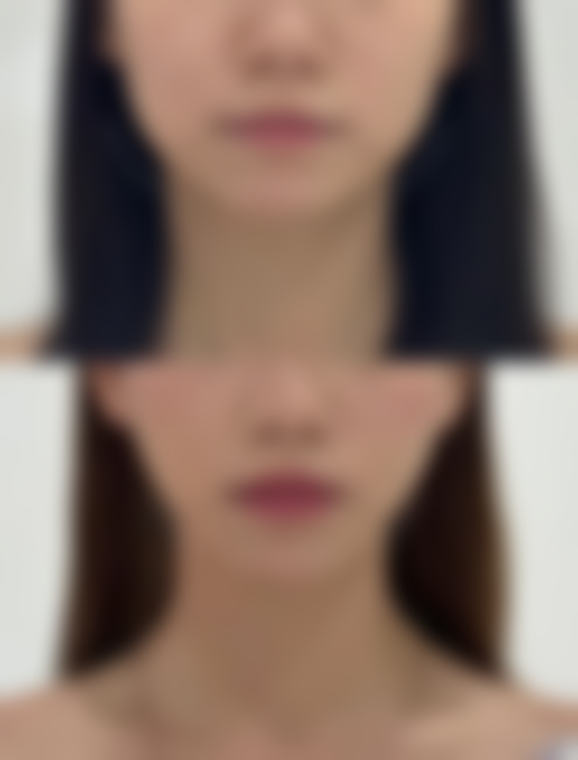 六、长春王巍医疗美容诊所价格表：（仅供参考）