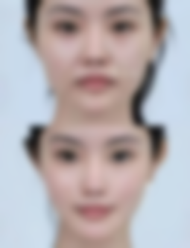 五、杭州4ever整形医院实例