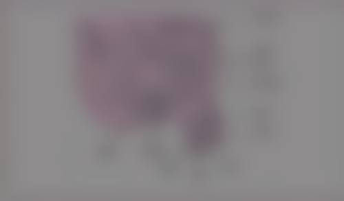 全切双眼皮术后15天增生别怕！一般护理措施特别重要