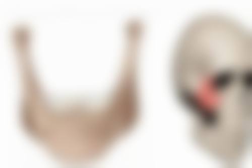 疤痕体质去除黑色素沉淀：手术治疗方案