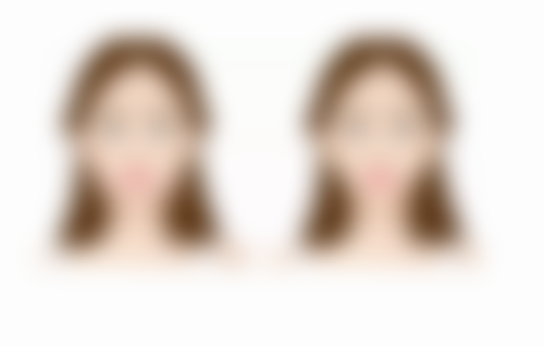 国产威宁、进口傲诺拉等隆胸假体怎么选？适配人群与核心优势全揭秘 