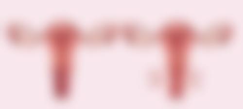 进口隆胸假体之美国品牌优势与适配人群分析