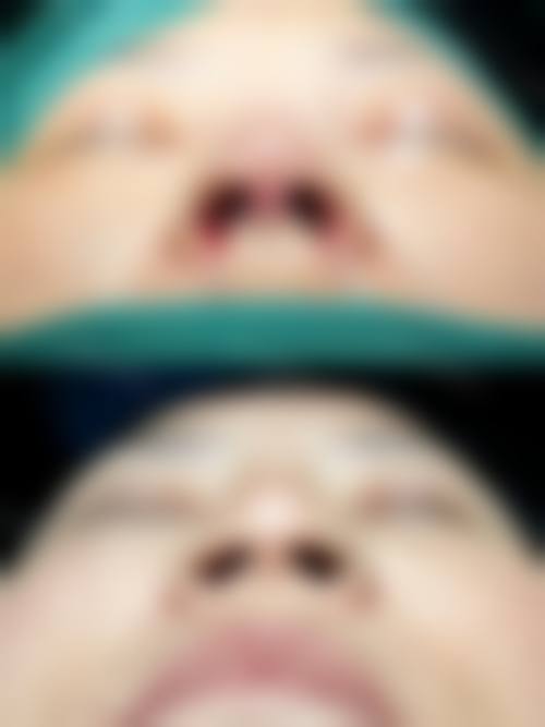 五、重庆宝丽医疗整形实例