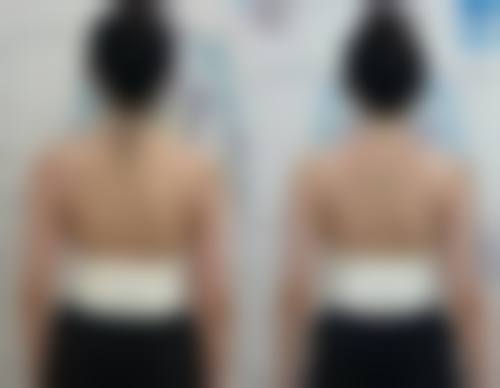 五、南京耀容貌医疗美容门诊部实例