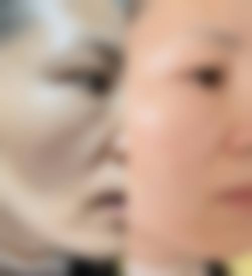 四、石家庄双美倍尔整形医院实例