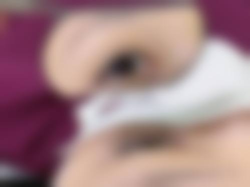 七、衡阳悦容医疗美容诊所真实的顾客评价如下：