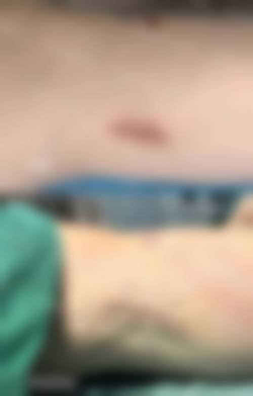 六、南京华肤医院怎么预约：