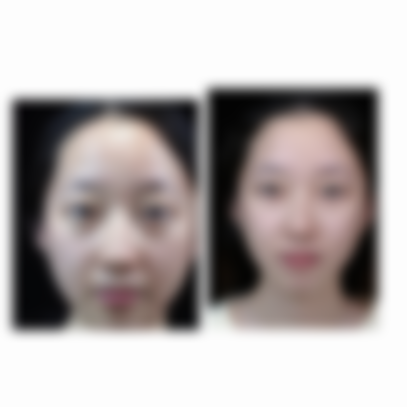 六、石家庄双美倍尔整形医院价格表：（仅供参考）