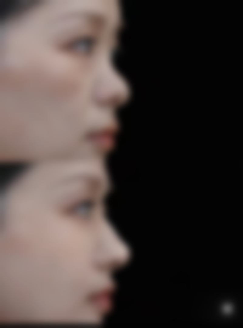 六、衡阳悦容医疗美容诊所价格表：（仅供参考）